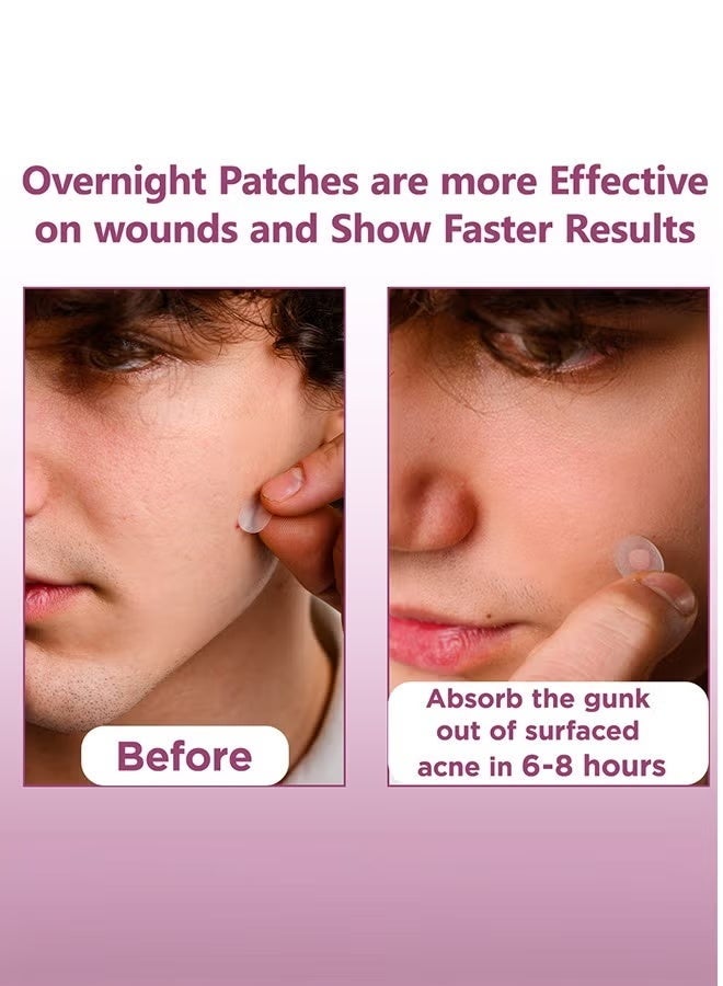 Floren Amazing Overnight Acne Patch | 28 Patches, 3 Sizes (8mm, 10mm, and 12mm) | Thick Hydrocolloid Acne Patch | More Effective with Extra Adhesion for Wound/Acne Healing | Acne Patch Stickers | South Korean Skincare | Drug-Free - Image 4